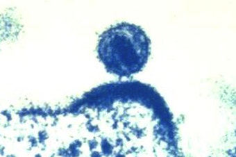 caption: A colorized electron microscope image from the National Institute of Allergy and Infectious Diseases shows a single human immunodeficiency virus budding from a human immune cell, which the virus had infected.